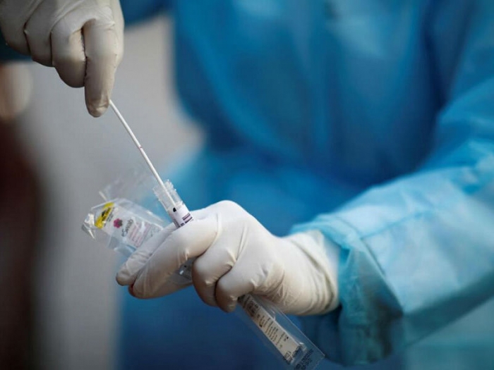 На Кубани 30 июля выявили 98 новых случаев заражения коронавирусом